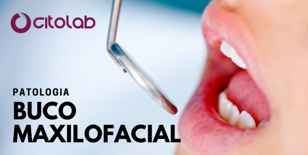 Liga Acadêmica LAPOPP em estágio prático no CITOLAB